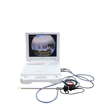 SY-PS045N Yüksek Kaliteli Hepsi bir arada Histeroskopi Tıbbi Endoskop Kamera Jinekoloji/Üroloji / ENT Görüntü