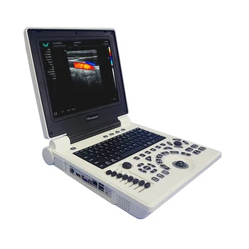 İnsanlar için E20 Dizüstü Renkli Taşınabilir Fetal Doppler Ultrason Teşhis Sistemi Görüntü
